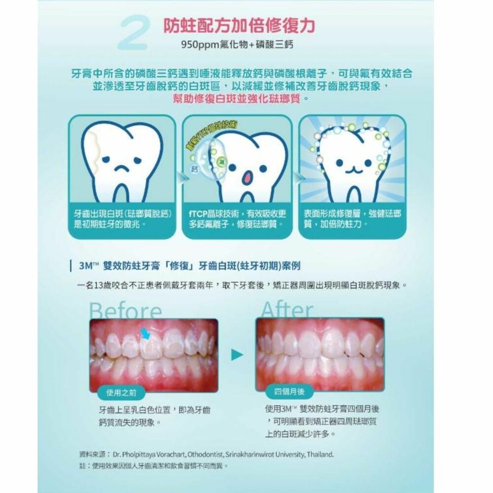 3M 雙效防蛀護齒牙膏-圖片-3